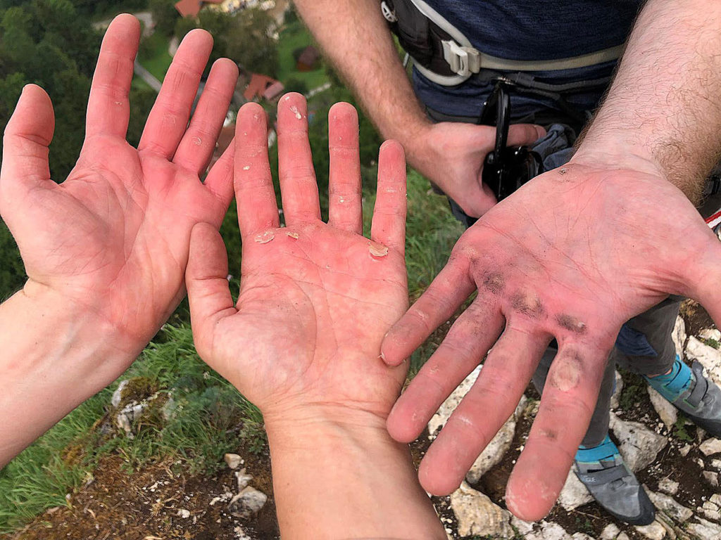 Trotz Handschuhen... - Foto: Tina Fellner